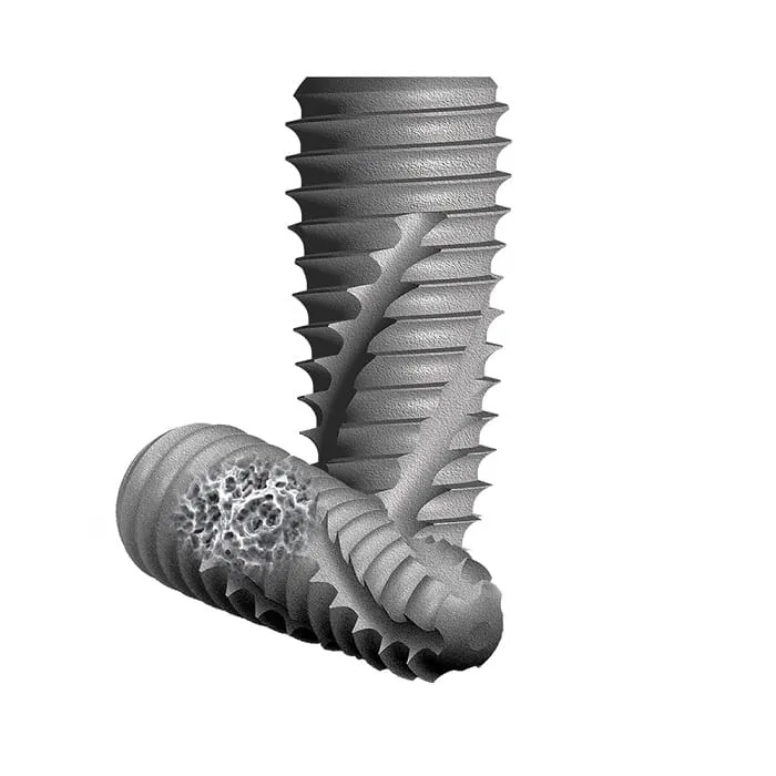 Implant dentar INNO (Coreea de Sud)
