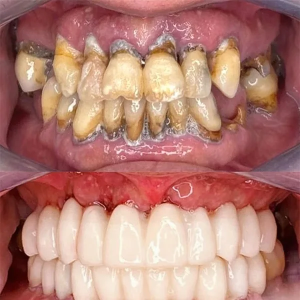 Cazul 26 - Înainte și după tratament
