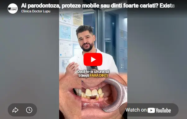 Ai parodontoza, proteze mobile sau dinti foarte cariati? Exista solutii!