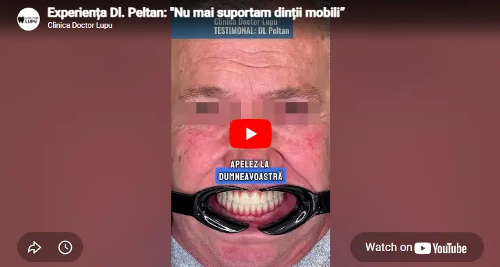 Experiența Dl. Peltan: "Nu mai suportam dinții mobili”
