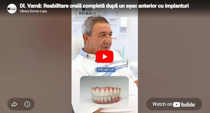 Dl. Vamă: Reabilitare orală completă după un eșec anterior cu implanturi