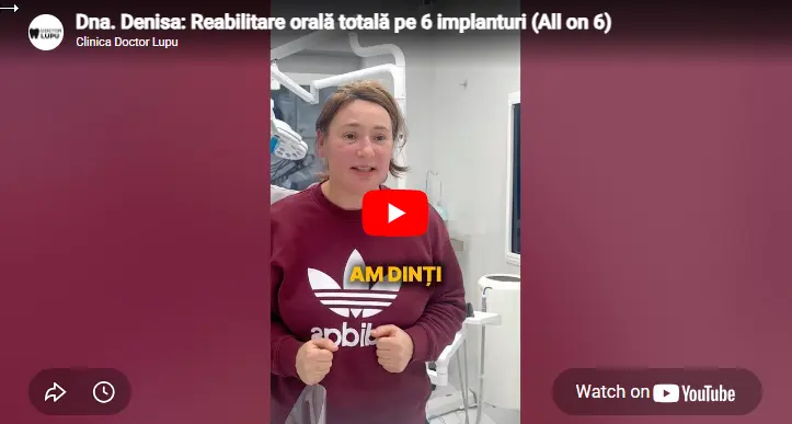 Dna. Denisa: Reabilitare orală totală pe 6 implanturi (All on 6)