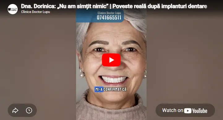 Dna. Dorinica: „Nu am simțit nimic” | Poveste reală după implanturi dentare