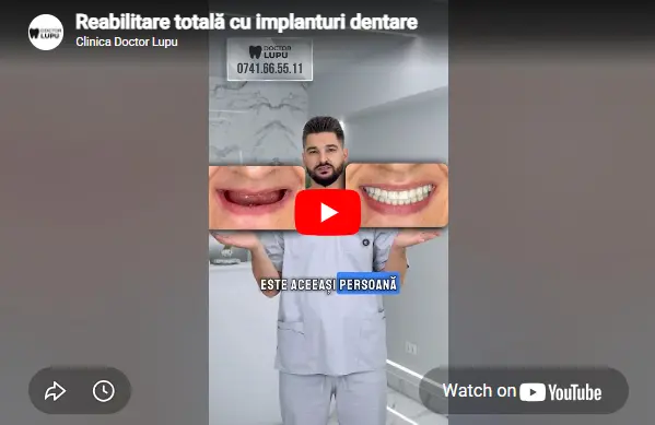 Reabilitare totală cu implanturi dentare